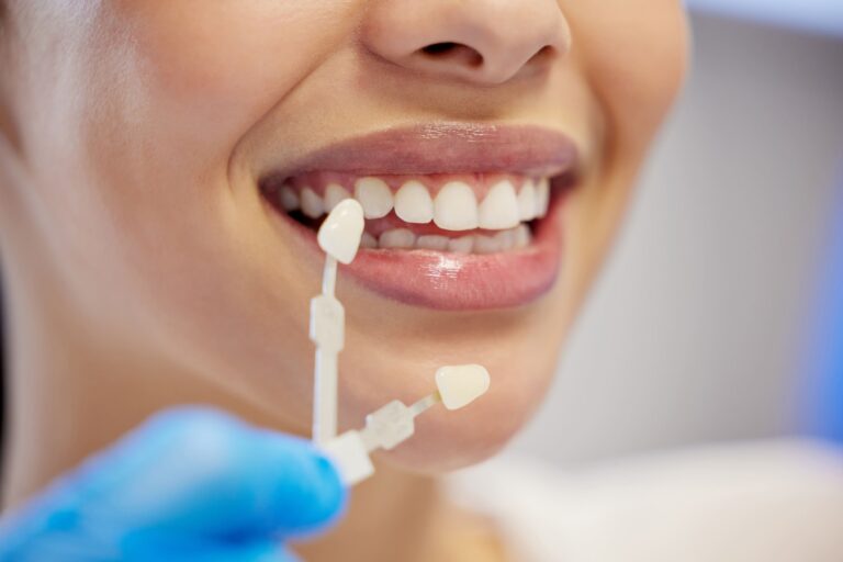 imagen de una paciente en la clinica dental eligiendo el color de las carillas dentales