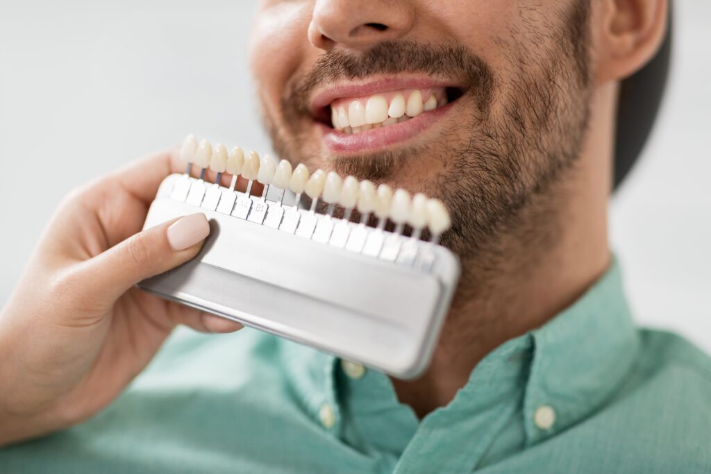 imagen de paciente de la clinica dental dr alcubierre en vilanova enseñando carillas
